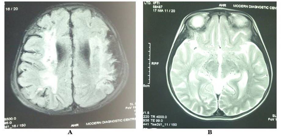 A close-up of a brain scan

Description automatically generated