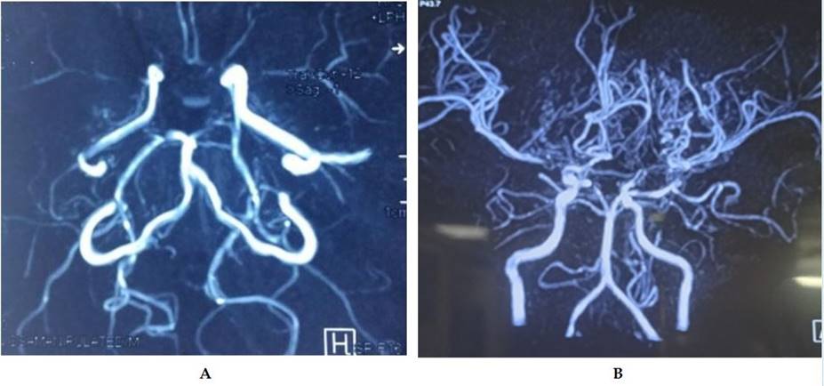 A close-up of a medical scan

Description automatically generated